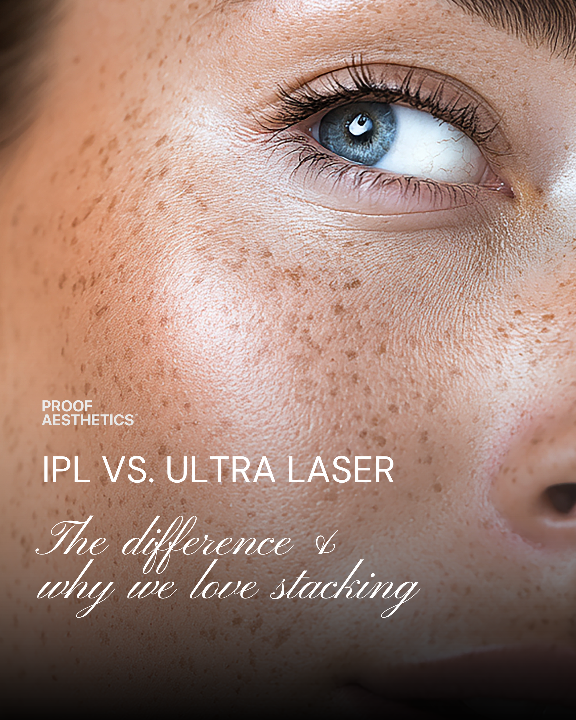 IPL vs. Ultra 1927nm Laser: What’s the Difference and Why We Love Stacking Them