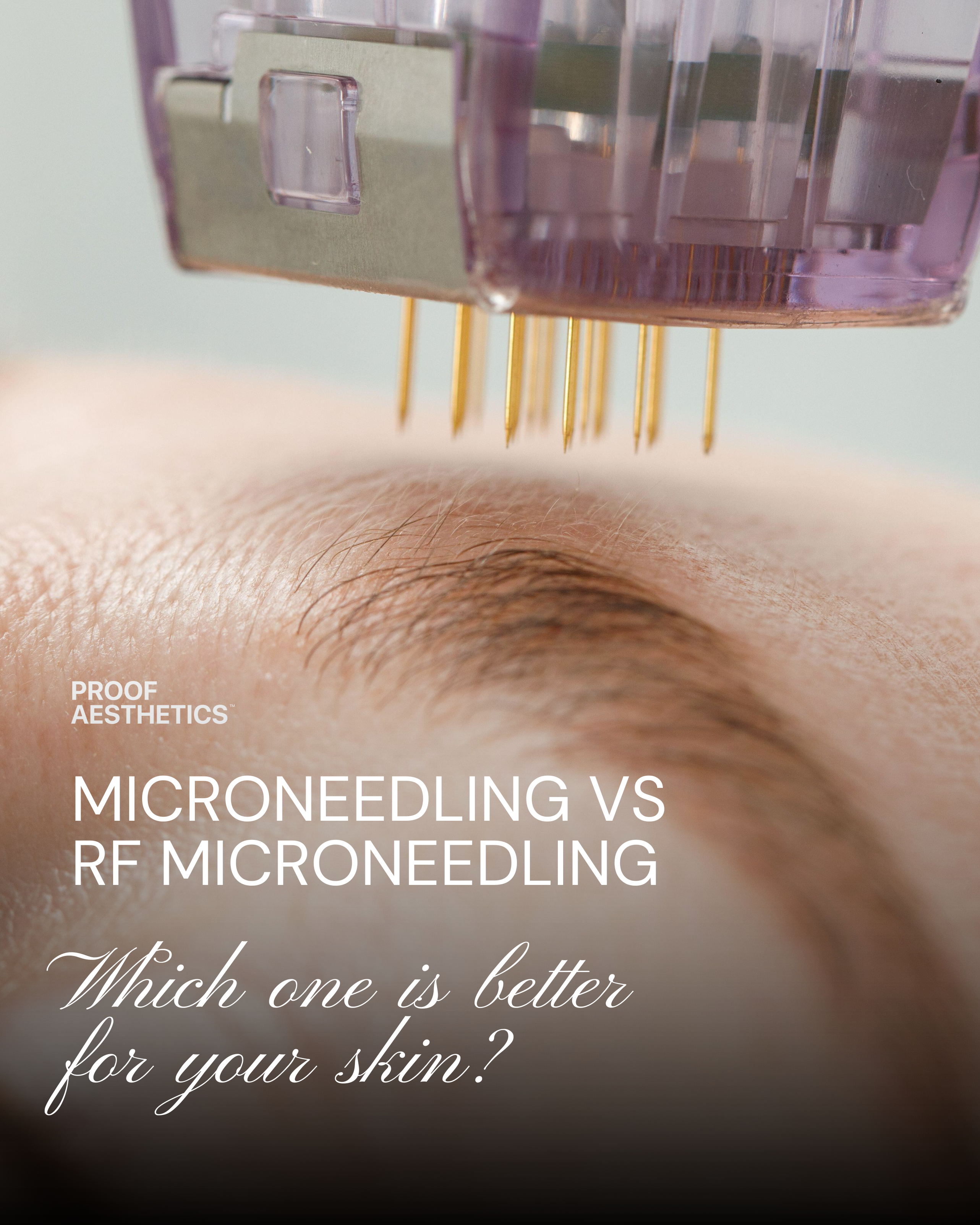 Microneedling vs RF Microneedling: Which Is Better for Your Skin?