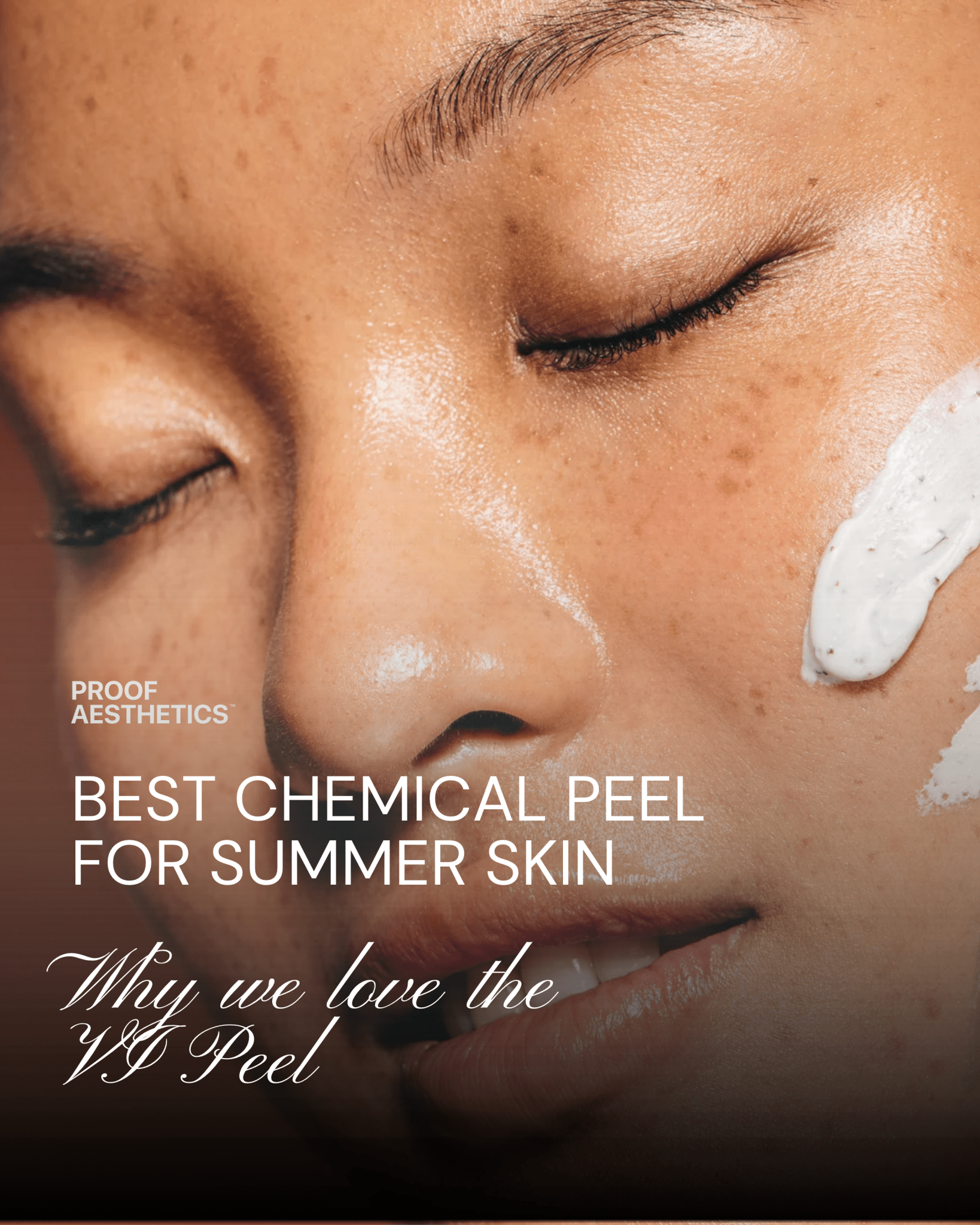Chemical Peel: Treat Sun Damage, Dark Spots & Uneven Texture - Proof Aesthetics